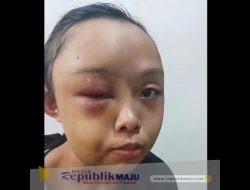Kasihan! Gadis Yatim Piatu Diduga Dianiaya Tante karena Cuci Pakaian Tak Bersih