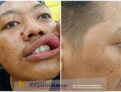 KAJ Soroti Laporan Dugaan Penganiayaan Jurnalis Beritajatim.com ke Polisi Jalan di Tempat